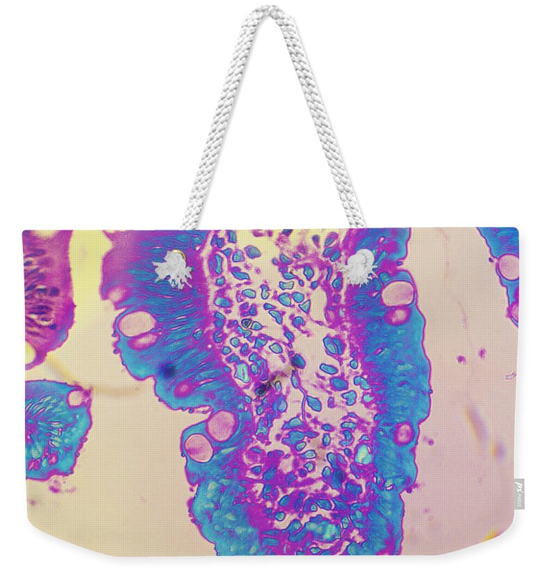 Histology Weekender Tote Bag featuring the photograph Cryptosporidium In Intestine Of Baby by Dr. Cecil H. Fox