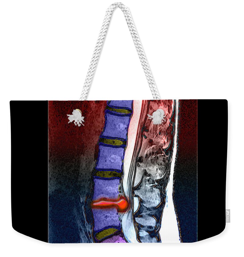 Magnetic Resonance Image Weekender Tote Bags