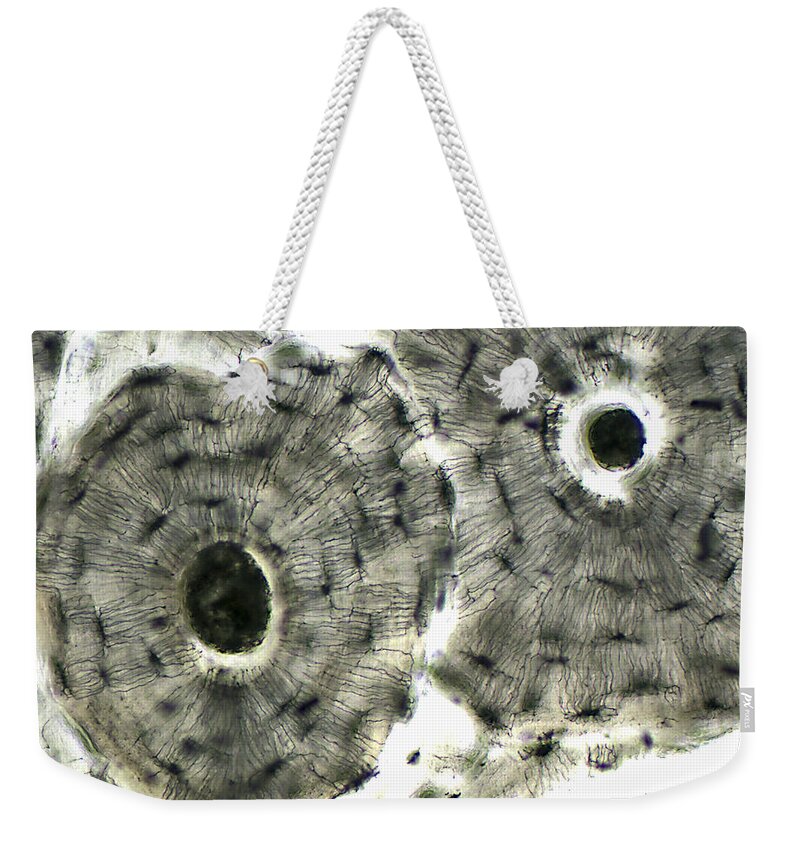 Mature Compact Bone Weekender Tote Bag featuring the photograph Mature Compact Bone Lm by Alvin Telser