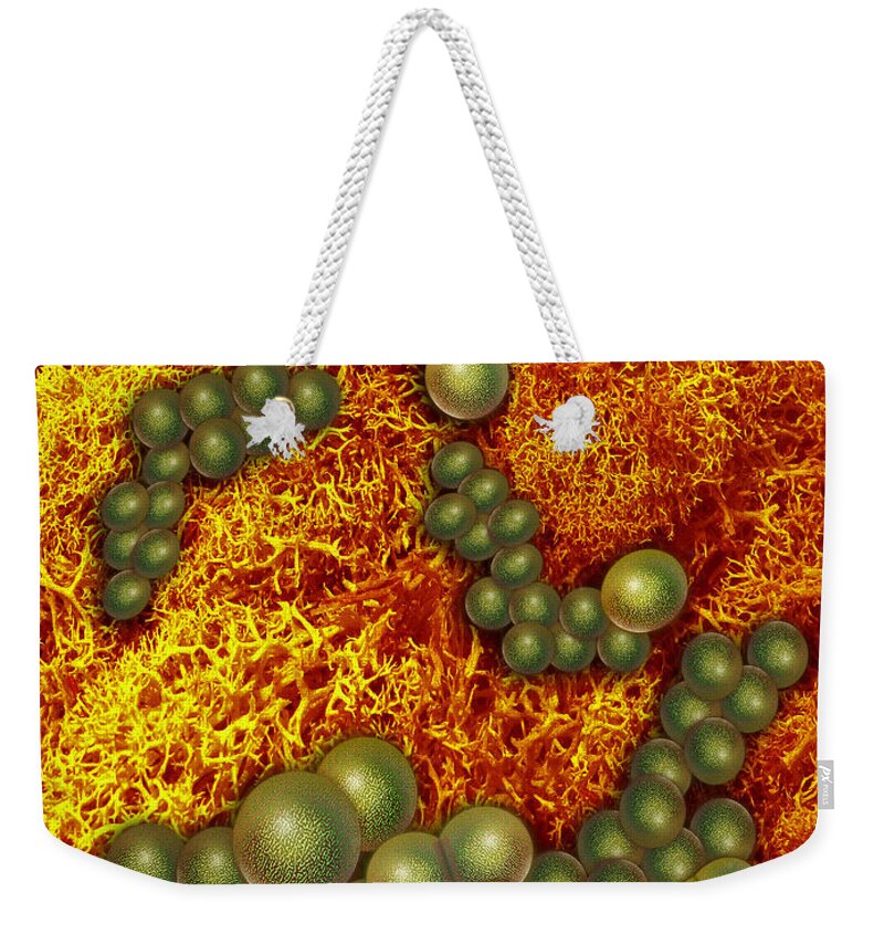 Science Weekender Tote Bag featuring the photograph Mrsa Staph Aureus Infecting Lung Tissue by Chris Bjornberg