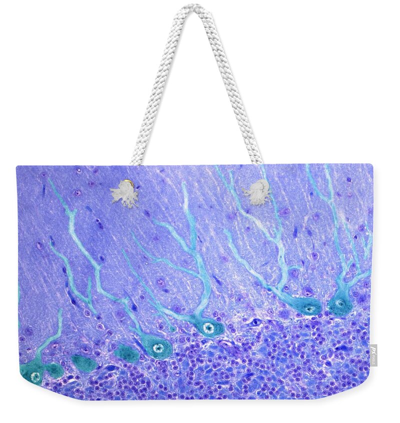 Brain Weekender Tote Bag featuring the photograph Nerve Cells, Light Micrograph by Science Photo Library - Steve Gschmeissner
