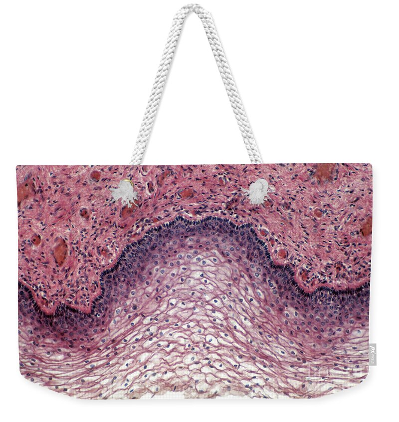 Magnified Weekender Tote Bag featuring the photograph Stratified Squamous Epithelium, Lm by Tierbild Okapia