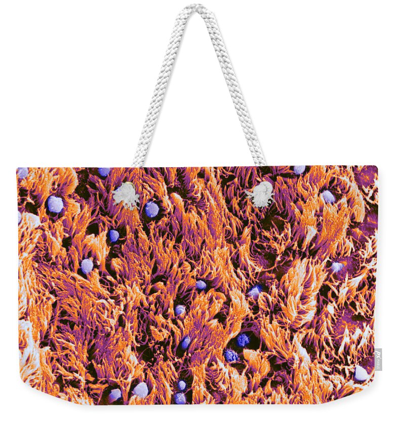Human Weekender Tote Bag featuring the photograph Trachea, Showing Cilia And Goblet by Biophoto Associates