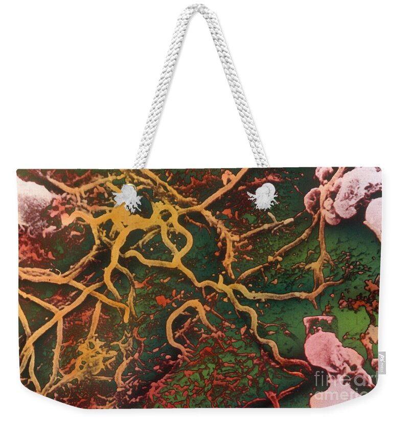 Science Weekender Tote Bag featuring the photograph Lyme Disease Sem #1 by Science Source