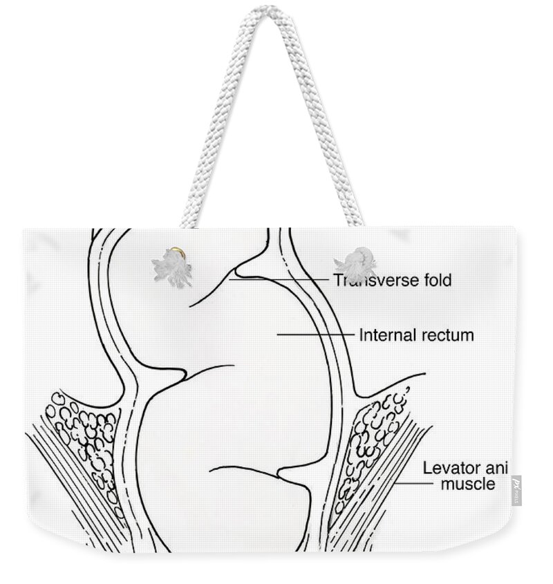 Anatomy Weekender Tote Bag featuring the photograph Illustration Of Rectum #8 by Science Source