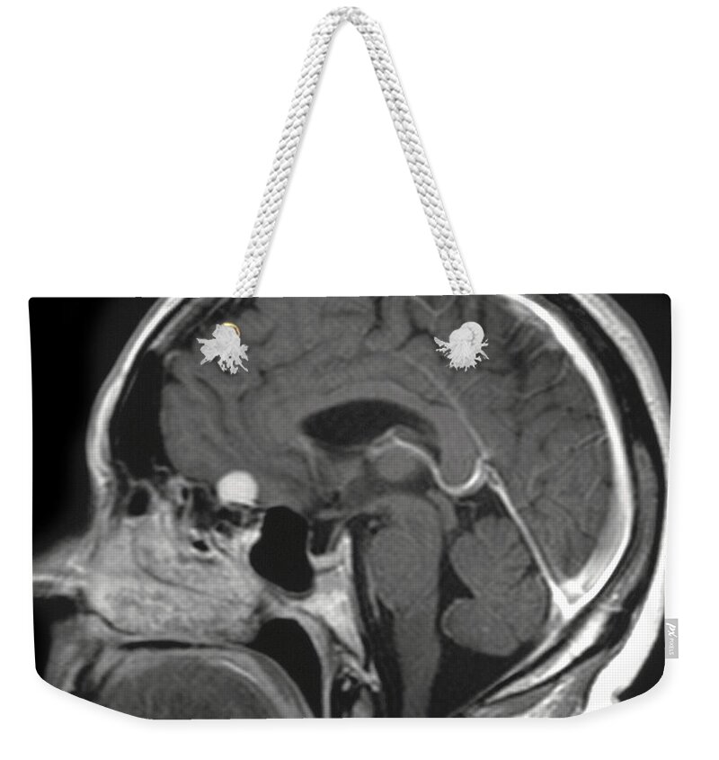 Mri Weekender Tote Bag featuring the photograph Cerebral Mri by Ted Kinsman