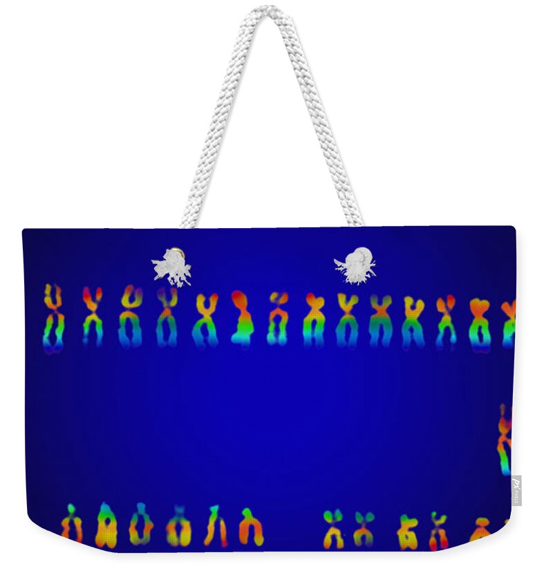 Down's Syndrome Weekender Tote Bag featuring the photograph Downs Syndrome Karyotype by Omikron