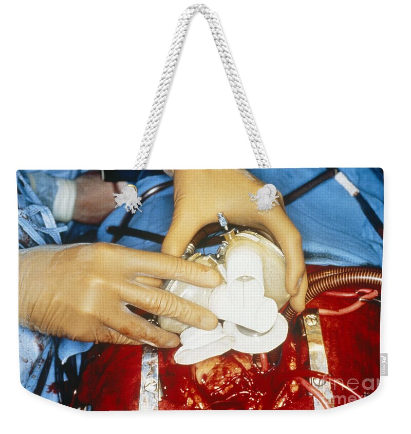 Implantation Weekender Tote Bag featuring the photograph Jarvik Artificial Heart by Science Source