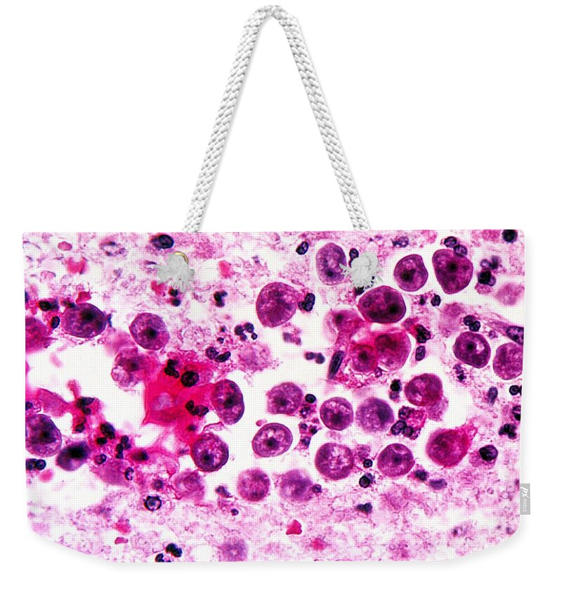 Micrograph Weekender Tote Bag featuring the photograph Naegleria Fowleri, Lm by Science Source