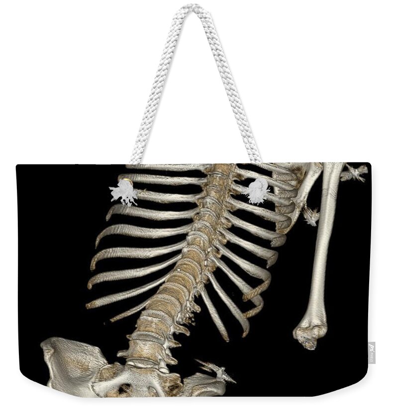 Science Weekender Tote Bag featuring the photograph Skeletal Reconstruction by Science Source