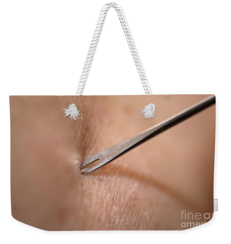 Science Weekender Tote Bag featuring the photograph Smallpox Vaccination, Bifurcated Needle by Science Source