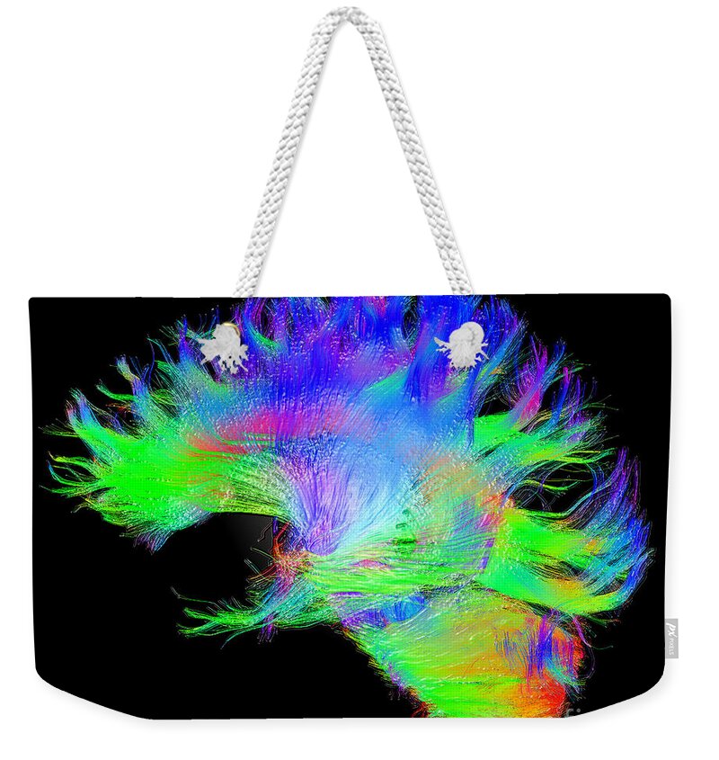 Brain Mri Weekender Tote Bag featuring the photograph Fiber Tracts Of The Brain, Dti #1 by Living Art Enterprises