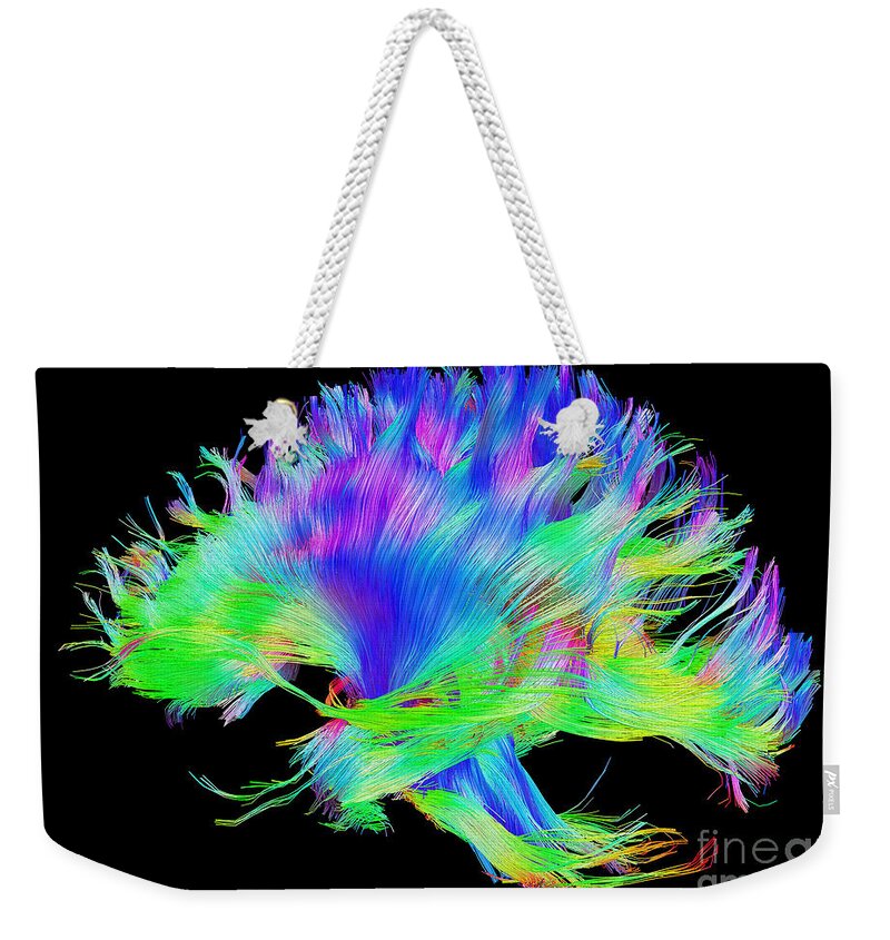Brain Mri Weekender Tote Bag featuring the photograph Fiber Tracts Of The Brain, Dti by Living Art Enterprises