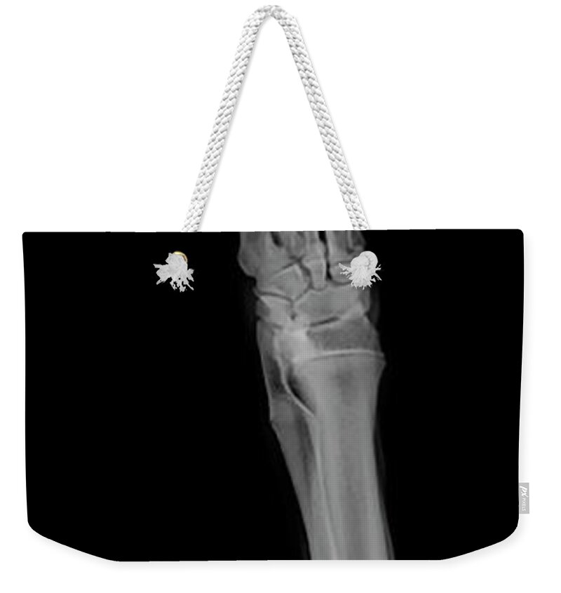 Dog Weekender Tote Bag featuring the photograph X-ray of a dog's front right leg #2 by Yael Rosen