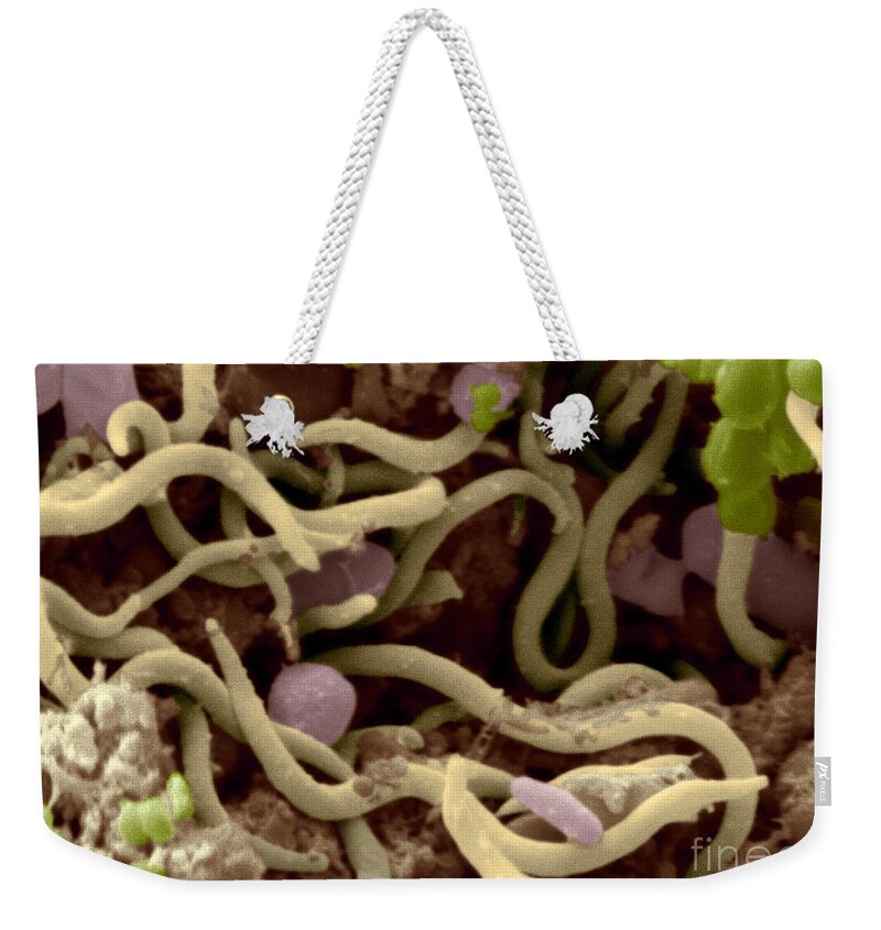 Hens Weekender Tote Bag featuring the photograph Chicken Excrement #3 by Scimat