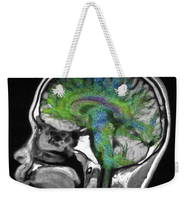 Mri Weekender Tote Bag featuring the photograph Normal Brain, Fiber Tractography And Mri #4 by Scott Camazine