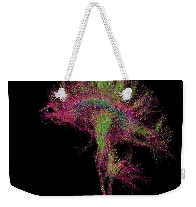 Mri Weekender Tote Bag featuring the photograph Brain, Fiber Tractography Image #5 by Scott Camazine