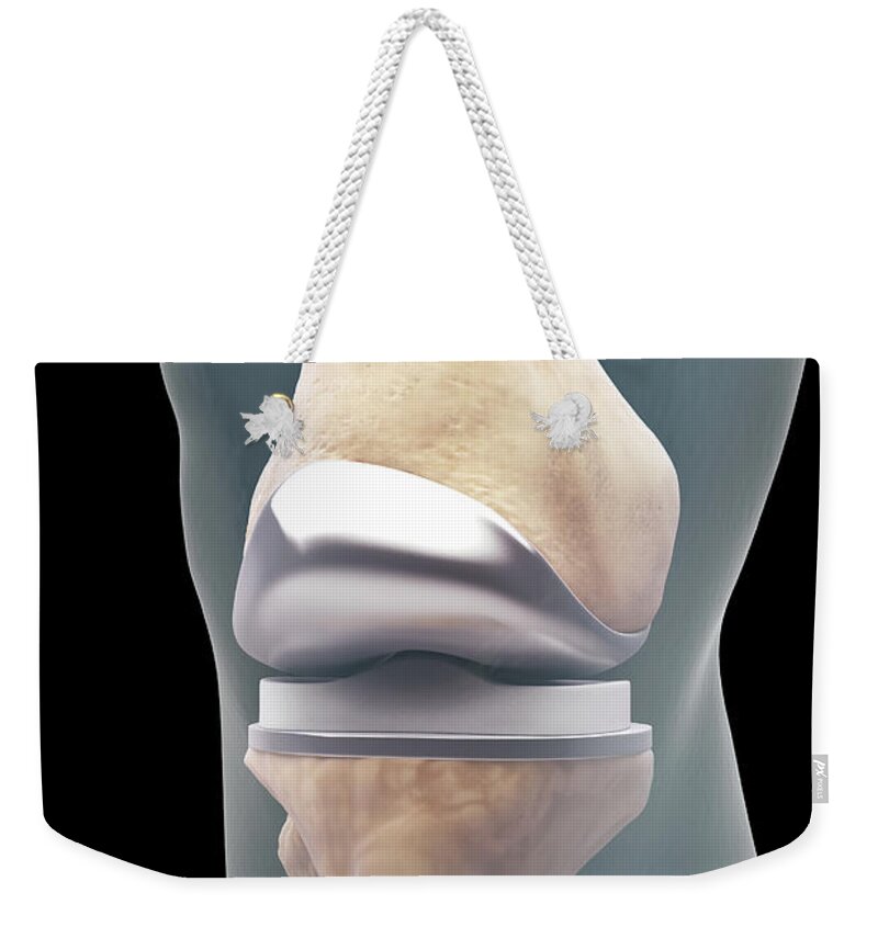 Digitally Generated Image Weekender Tote Bag featuring the photograph Knee Replacement #5 by Science Picture Co