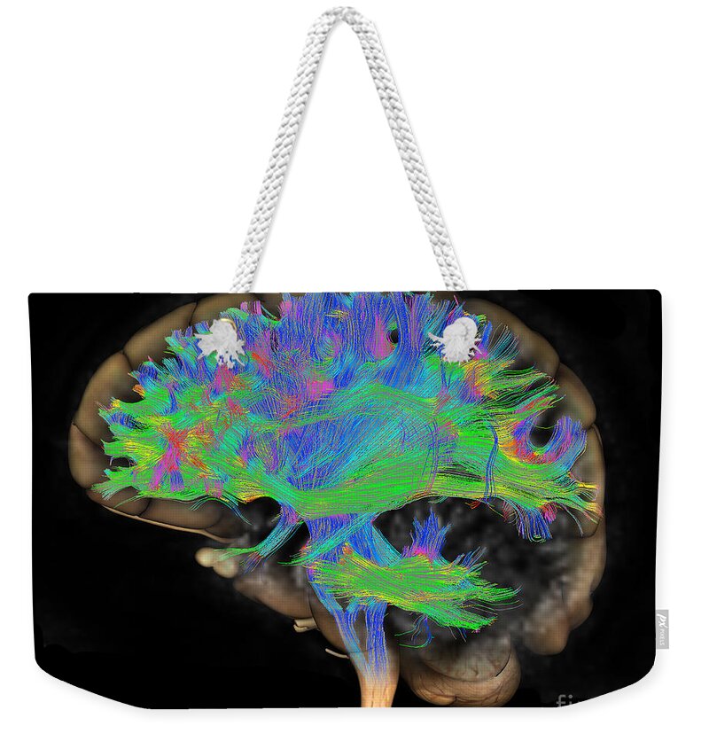 Mri Weekender Tote Bag featuring the photograph Brain, Fiber Tractography Image #8 by Scott Camazine