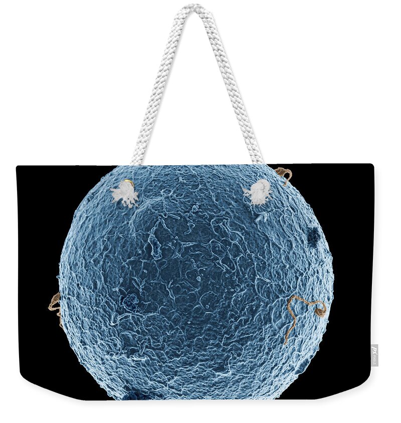 Anatomical Weekender Tote Bag featuring the photograph Human egg cell and sperm cells ESEM by Spl