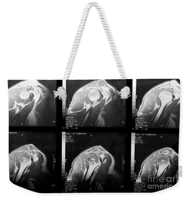 Rotator Cuff Weekender Tote Bag featuring the photograph MRI of Rotator Cuff by Karen Foley