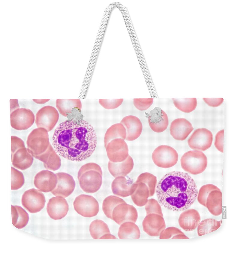 Neutrophil Polymorphs Weekender Tote Bag featuring the photograph Neutrophils In Peripheral Blood Smear by M. I. Walker
