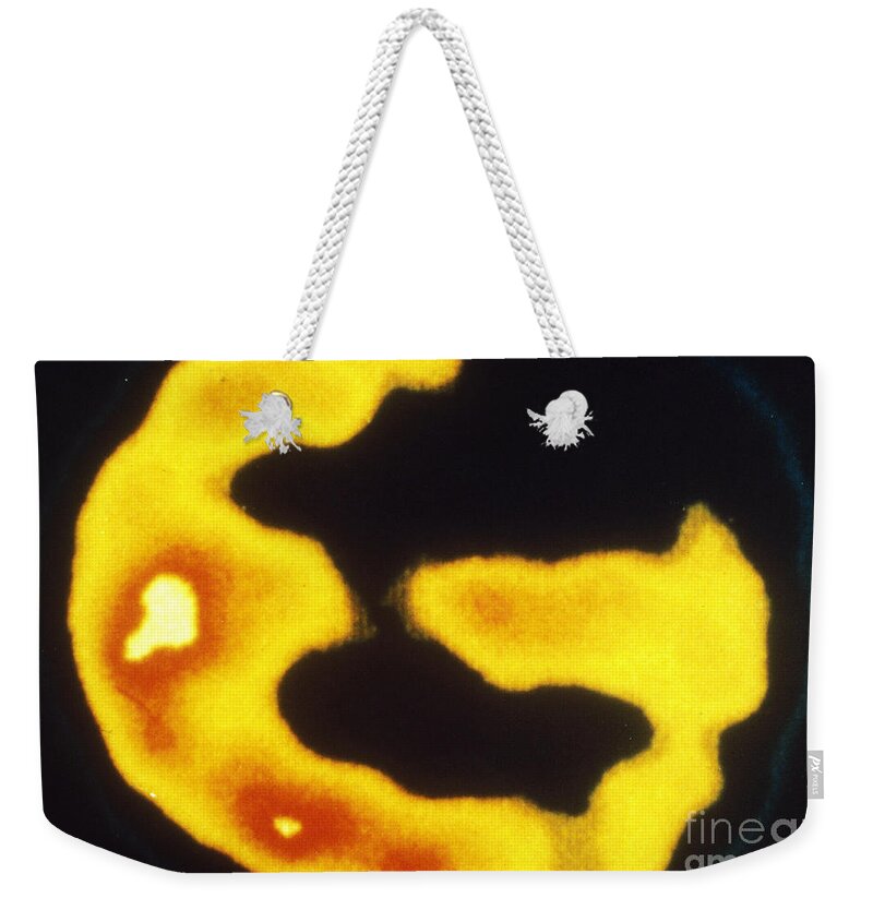 Pet Scan Weekender Tote Bag featuring the photograph Pet Brain Scan Of Alzheimers Disease by National Institute of Neurological and Communicative Disorders and Stroke