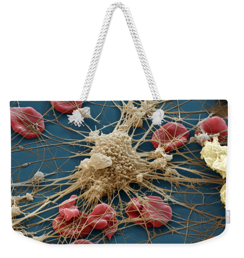 Blood Weekender Tote Bag featuring the photograph Blood Cells #2 by Meckes/ottawa