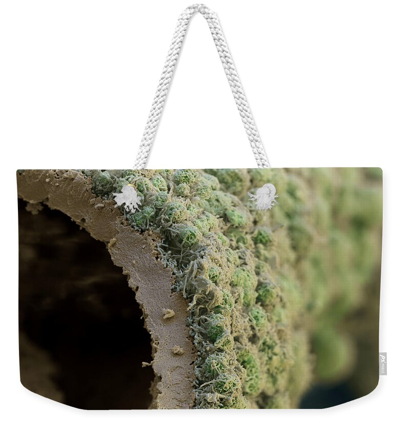 Algae Weekender Tote Bag featuring the photograph Trumpet Lichen #2 by Meckes/ottawa