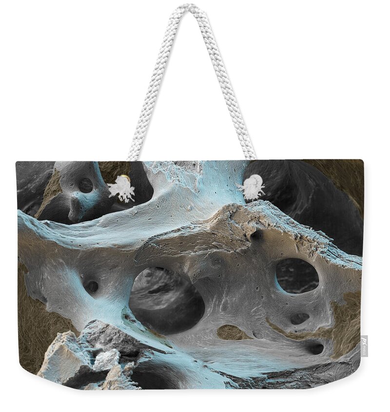 Bone Weekender Tote Bag featuring the photograph Osteoporotic Bone #7 by Meckes/ottawa