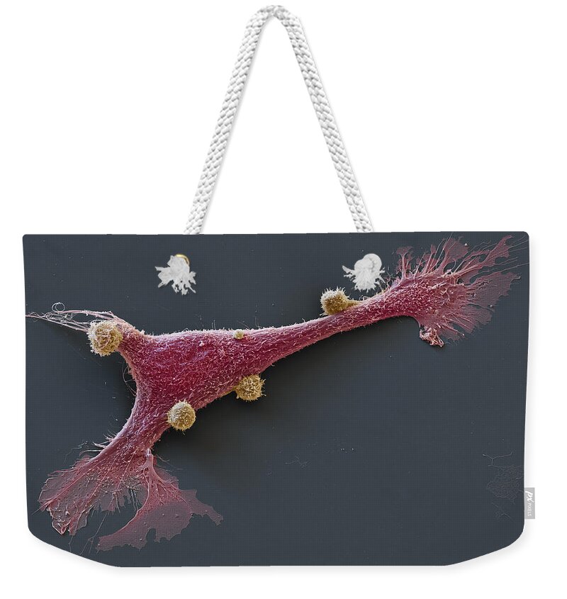 Adenocarcinoma Weekender Tote Bag featuring the photograph Breast Cancer Cells With Car Cells, Sem #8 by Meckes/ottawa