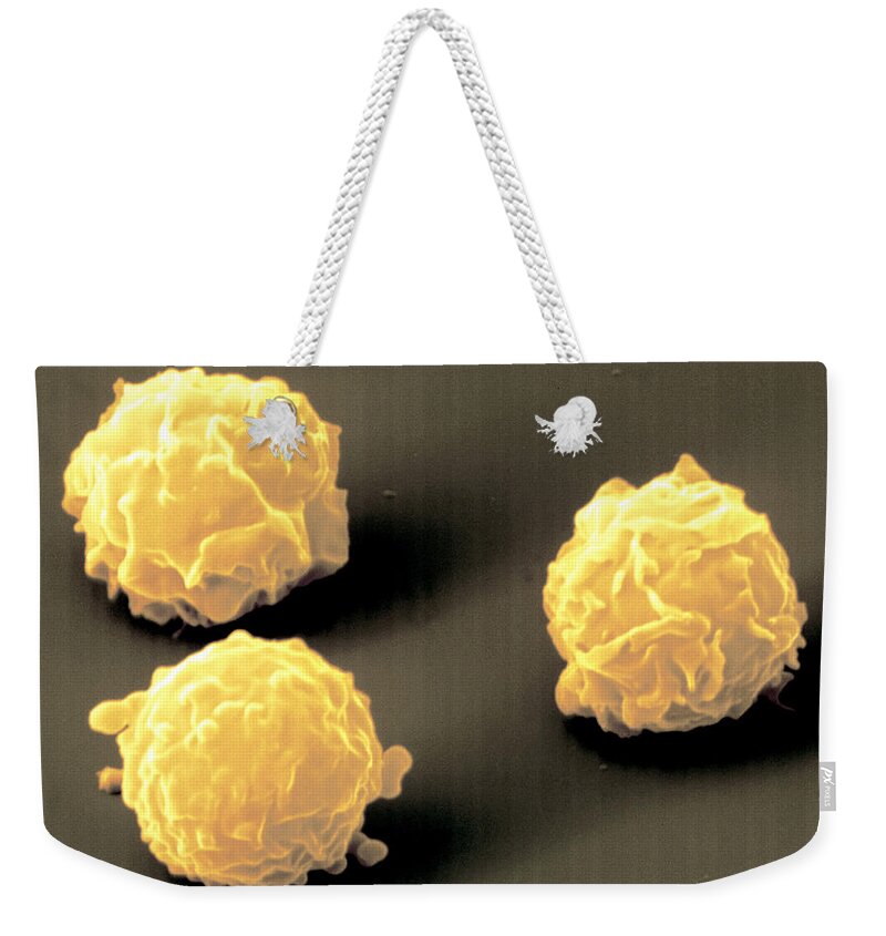 Bone Cell Weekender Tote Bag featuring the photograph Bone Marrow Stem Cells by Meckes/ottawa