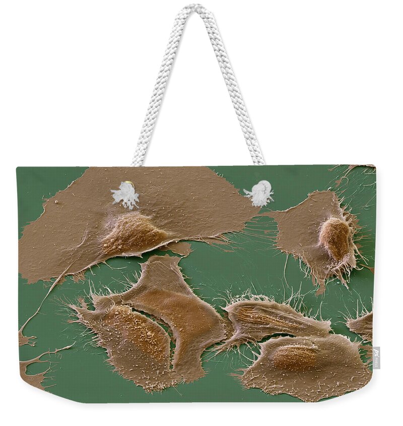 Cancer Weekender Tote Bag featuring the photograph Prostate Cancer Cells, Sem by oliver MECKES/OTTAWA