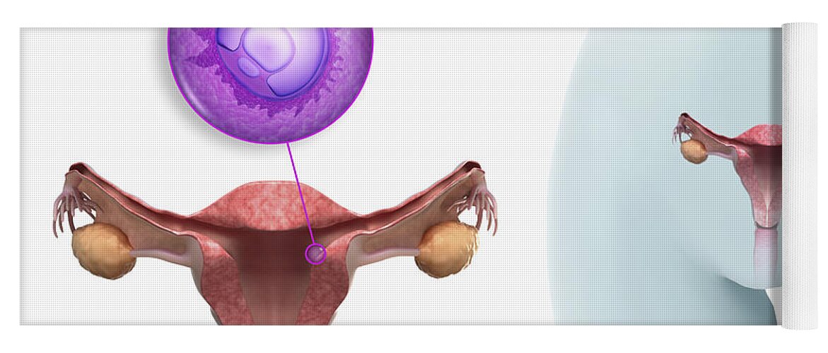 Biomedical Illustration Yoga Mat featuring the photograph Implanted Blastocyst #1 by Science Picture Co