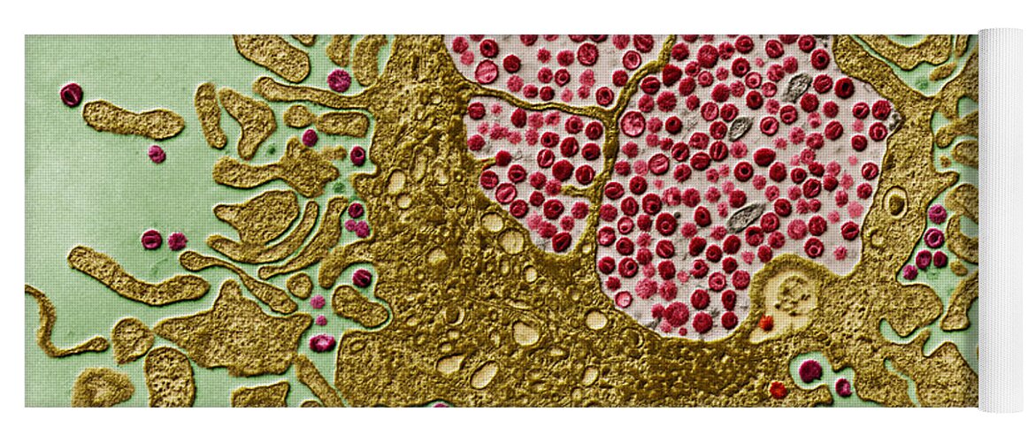 Viruses Yoga Mat featuring the photograph Hiv And Lymphocyte, Tem by Eye of Science