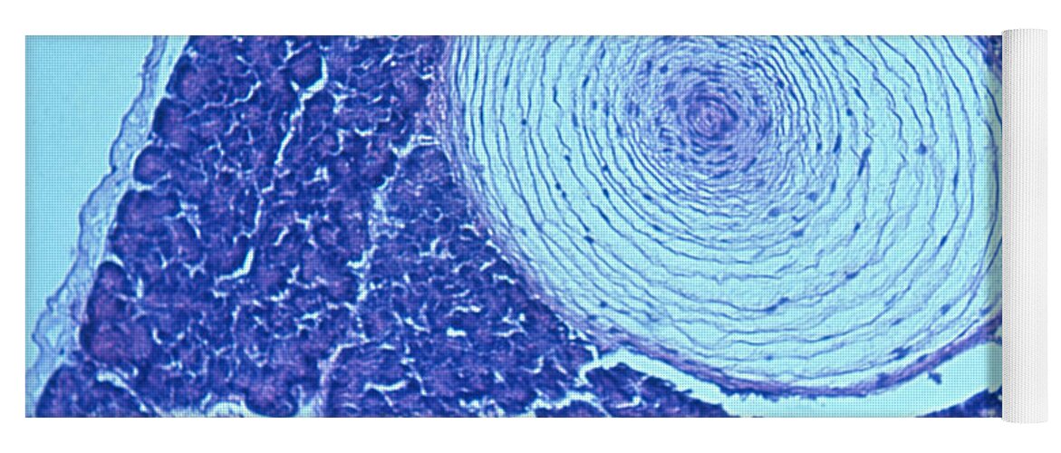 Healthy Yoga Mat featuring the photograph Pacinian Corpuscle, Lm by Ray Simons