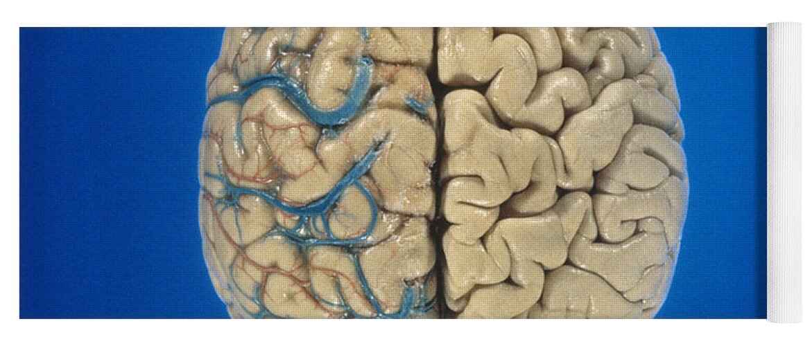 Anatomy Yoga Mat featuring the photograph Superior View Of Brain by David Bassett