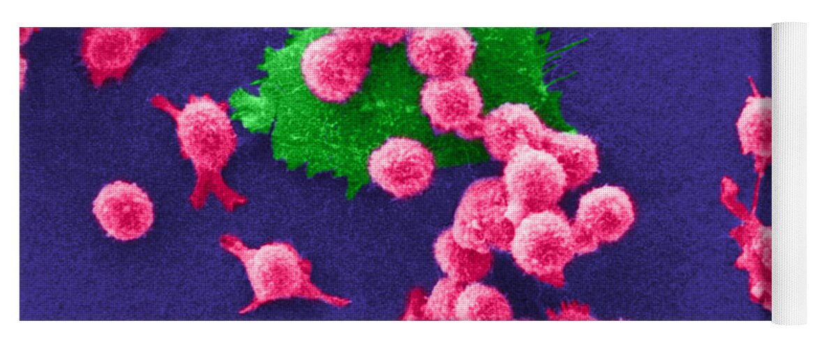 Scanning Electron Micrograph Yoga Mat featuring the photograph Cancer Cell Death, Sem 2 Of 6 #2 by Science Source