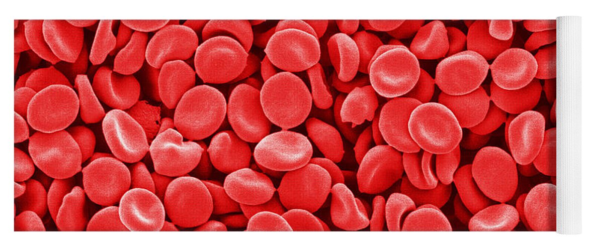 Red Blood Cells Yoga Mat featuring the photograph Red Blood Cells, Sem by Scimat