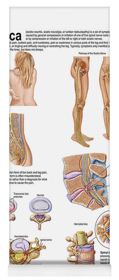 Sical Injury Yoga Mat featuring the digital art Stk701050h by Stocktrek Images