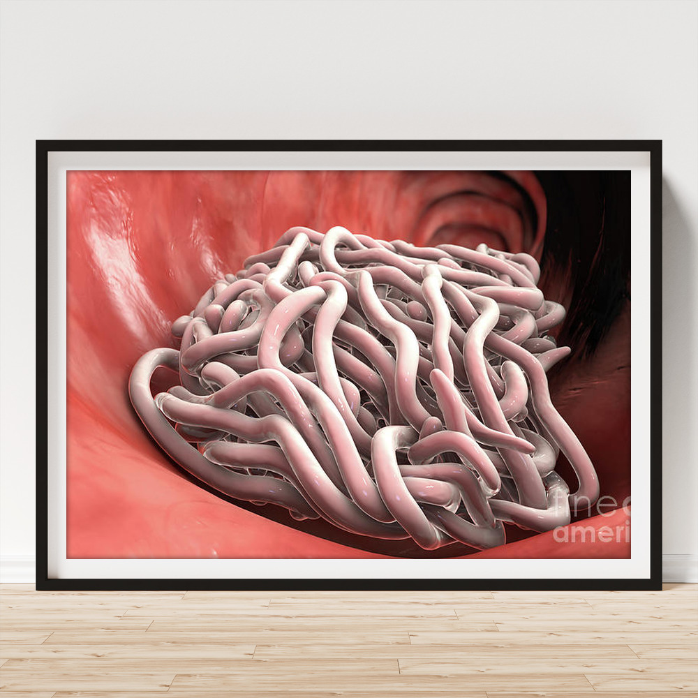Round Worms In Human Intestine #29 Art Print by Kateryna Kon/science Photo  Library