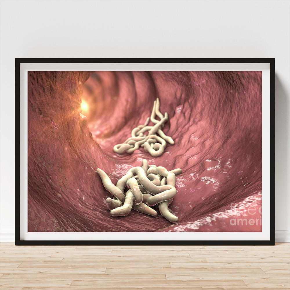 Round Worms In Human Intestine #29 Metal Print by Kateryna Kon