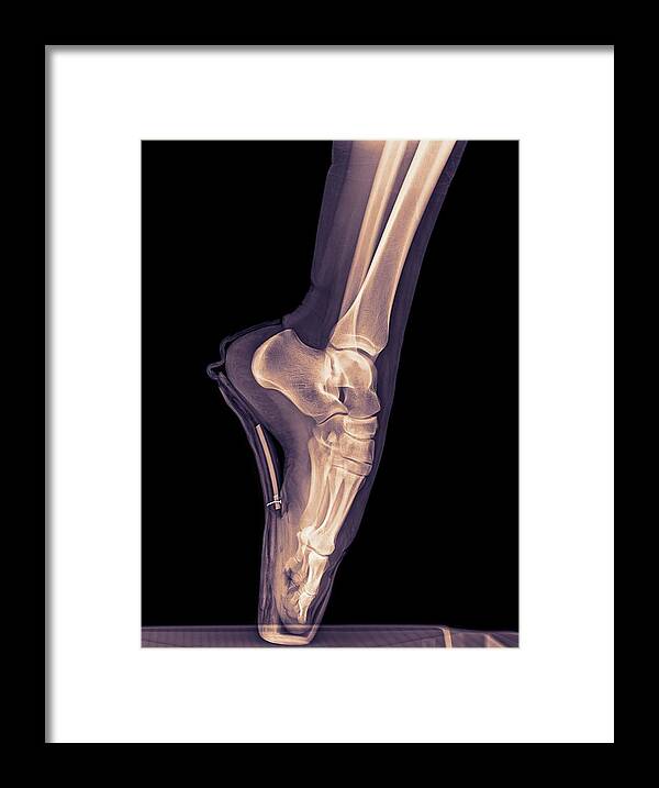 Agility Framed Print featuring the photograph Ballet Dancer X-ray #1 by Photostock-israel