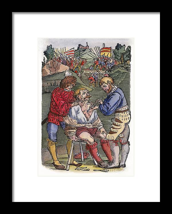 1540 Framed Print featuring the photograph Battlefield Surgeon, 1540 #1 by Granger