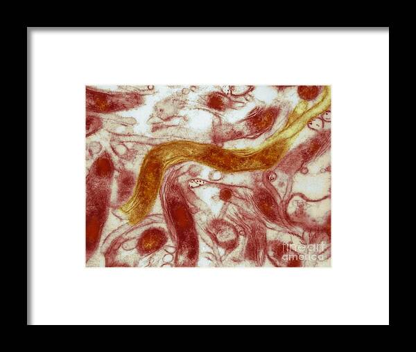 Science Framed Print featuring the photograph Borrelia Burgdorferi Lyme Disease, Tem #1 by David M. Phillips