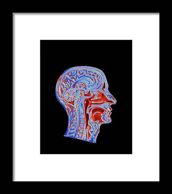 People Person Persons Framed Print featuring the photograph Coloured Ct Scan Of A Head Showing A Healthy Brain #1 by Pasieka