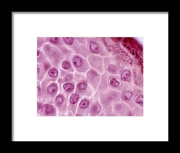 Skin Framed Print featuring the photograph Epidermis Lm by Alvin Telser