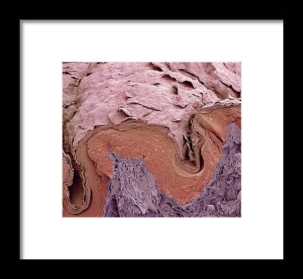 Scanning Electron Micrograph Framed Print featuring the photograph Finger skin, SEM #1 by Science Photo Library