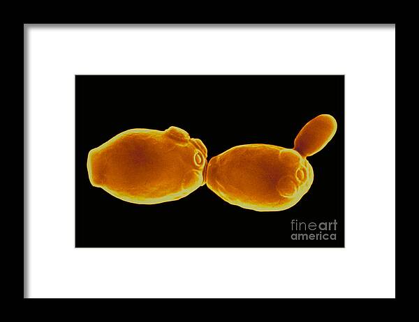 Color Enhanced Framed Print featuring the photograph Fungus, Candida Albicans, Sem #1 by Stem Jems