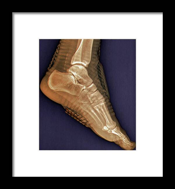 Radiography Framed Print featuring the photograph Healthy Ankle Joint #1 by Zephyr/science Photo Library